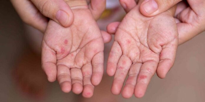 1715878845_3565f43ffc1f5bf2a06b