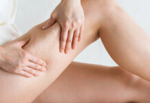 Regeneración real para celulitis, estrías y flacidez