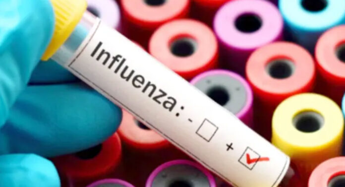 INFLUENZA