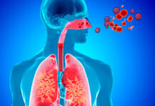 Cuídese: reportan en Oaxaca ola de contagios de Infecciones Respiratorias Agudas; 12 mil 784 casos en una semana