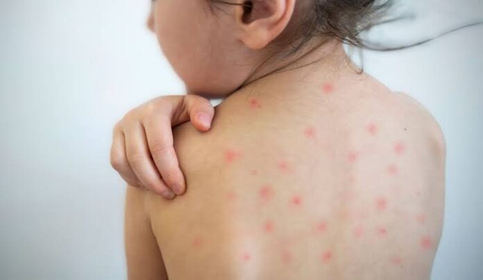 WhatsApp Image 2026-04-02 at 3.03.42 PM