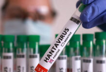 Hospitalizan en Ámsterdam a azafata con posibles síntomas de hantavirus tras contacto con una persona contagiada en el crucero